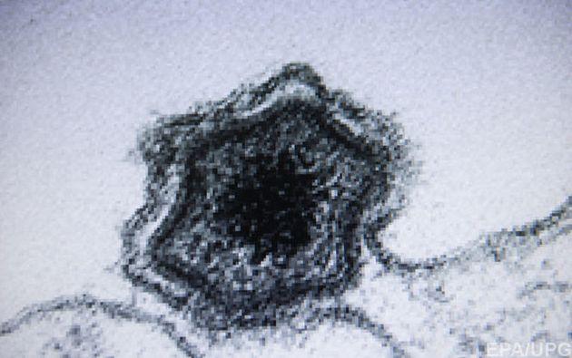 Фото вируса под микроскопом